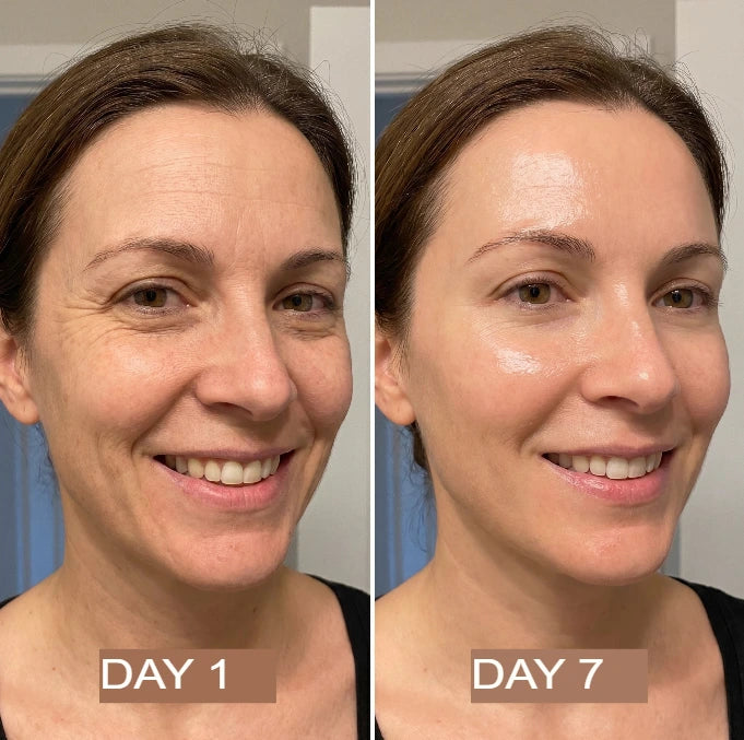 NutraSkin™ Collagen Oil | Tightens and lifts sagging skin by 98% within 24 hours