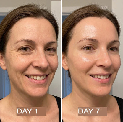 NutraSkin™ Collagen Oil | Tightens and lifts sagging skin by 98% within 24 hours