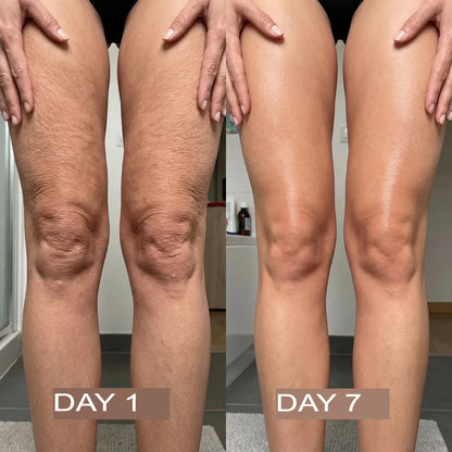 NutraSkin™ Collagen Oil | Tightens and lifts sagging skin by 98% within 24 hours